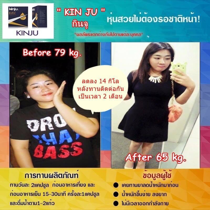 kinju คินจู ลดน้ำหนัก โปรโมชั่นพิเศษ