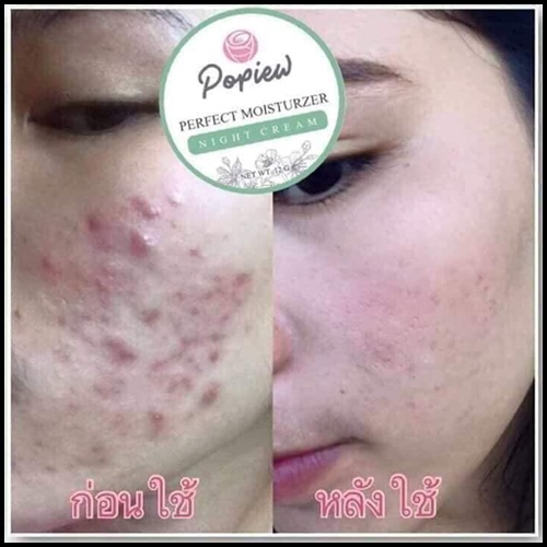 ไนท์ครีมปอปิ๋ว Popiew Nigth Cream ครีมขมิ้น ลดสิว ลดฝ้า