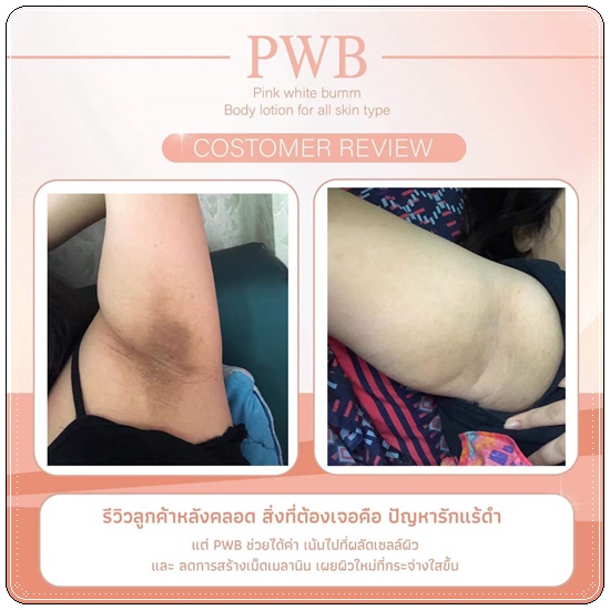 ครีม PWB Prink White Bumm