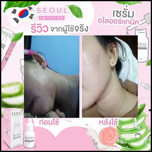 เซรั่มโซล Seoul Organic Aloe Serum เซรั่มอโลออร์แกนิค เข้มข้น