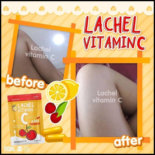LACHEL VITAMIN C ลาเชล ซี