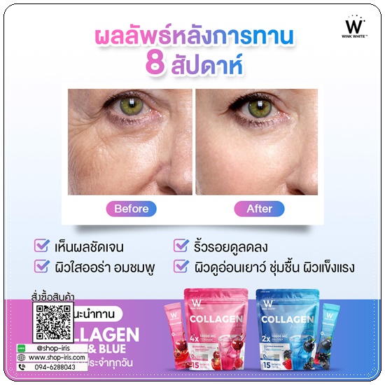 W Collagen สูตรใหม่ (1แถม1)