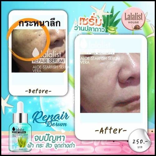 เซรั่มว่านปลาดาว Lalalist Repair Serum