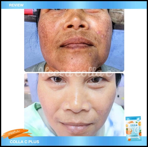 คอลล่า วิตซี พลัส Colla Vit C Plus