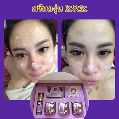 ใหม่ เซตครีมองุ่นหน้าใส K&K Beautiful (10กรัม)