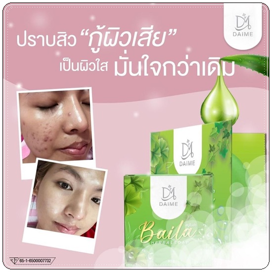 สบู่ใบล่า Baila Herbal Soap DAIME