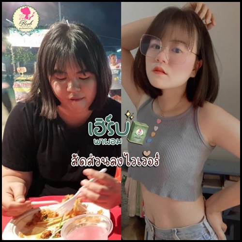 Korse by Herb คอร์เซ่ บาย เฮิร์บ (เฮิร์บ วีไอพี Herb VIP แพคเก็จใหม่)