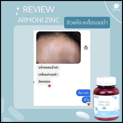 อาโมนิซิงค์ Amoni Zinc ลดสิว