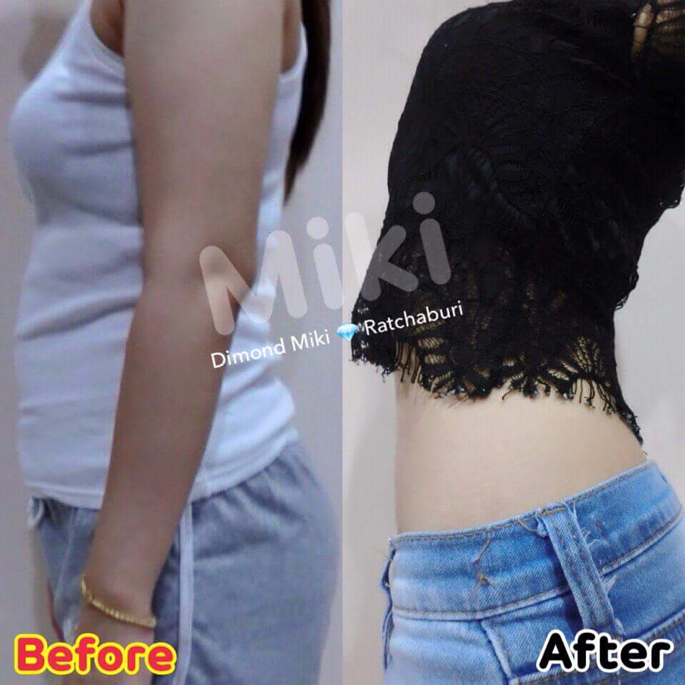 มิกิ ดีท็อกซ์ ไฟเบอร์ (MIKI Detox Fiber)