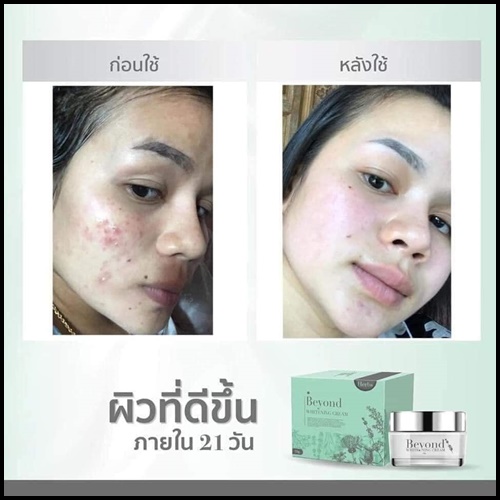 ครีมบียอนด์ Beyond Whitening Cream ครีมหน้าใสใน 21 วัน