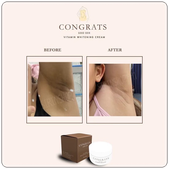 ครีมรักแร้ขาว Intensive Underarm Congrats Good Skin (แพ็คเก็จใหม่)