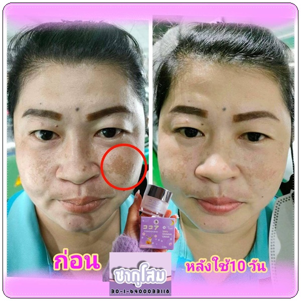 ซากุโสม Saku Ginseng Cream By Fondokmai