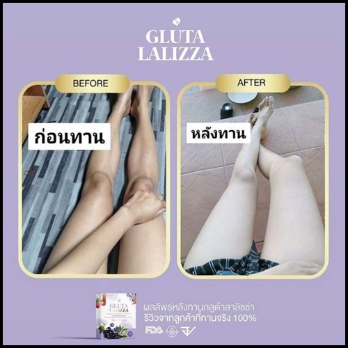 กลูต้าลาลิซซ่า Gluta Lalizza ส่งฟรี