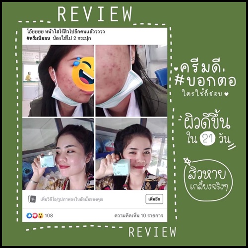 ครีมบียอนด์ Beyond Whitening Cream ครีมหน้าใสใน 21 วัน
