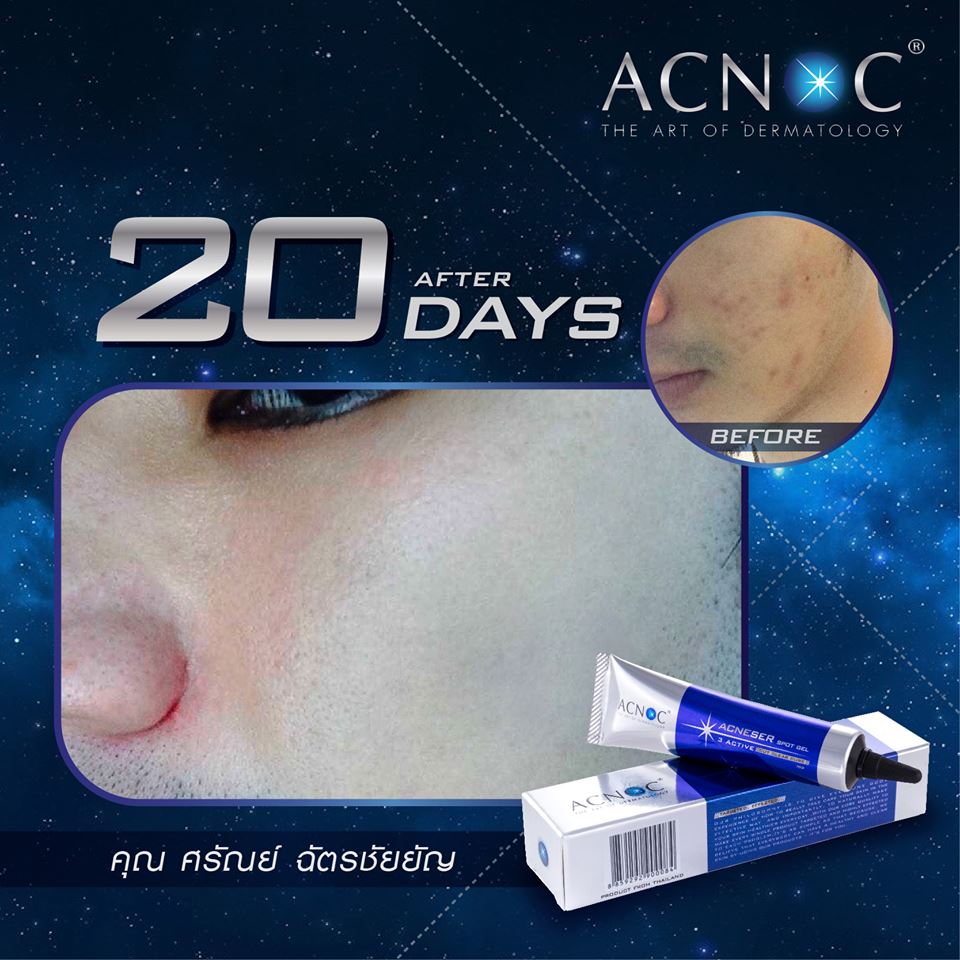 เจลแต้มสิว ACNOC - Acneser Spot Gel