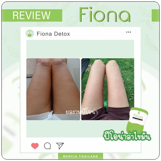 Fiona Glam Mercia ฟิโอน่า