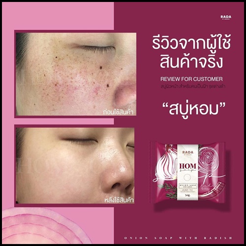 สบู่หอม HOM SOAP By RADA ลดฝ้า กระ จุดด่างดำ