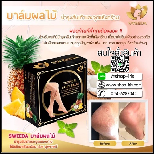 ทรอปปิคอล ฟรุ๊ต บาล์ม บำรุงส้นเท้าแตกและจุดแห้งกร้าน Tropical fruit balm by sweeda