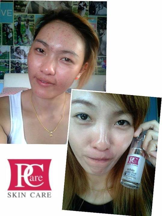 ขาย เซรั่ม ไวท์ บูสเตอร์ ไนท์ Pcare WHITE BOOSTER NIGHT SERUM by Pcare