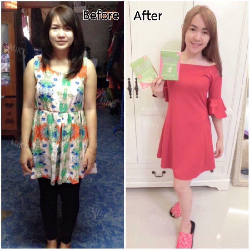 มิกิ ดีท็อกซ์ ไฟเบอร์ (MIKI Detox Fiber)