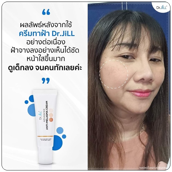 ครีมทาฝ้า Dr.Jill Advanced Anti-Melasma Cream (ส่งฟรี)