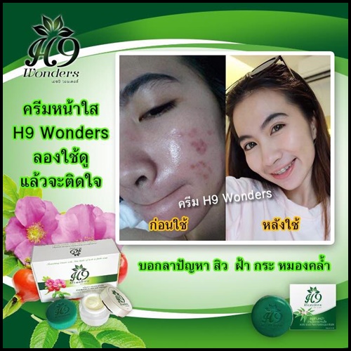 เอชไนน์ วอนเดอส์ H9 Wonders ครีมบำรุงผิวหน้ากระจ่างใส