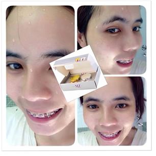 ครีมมินโซว MZ MinZol Night Cream Whitening and Repair
