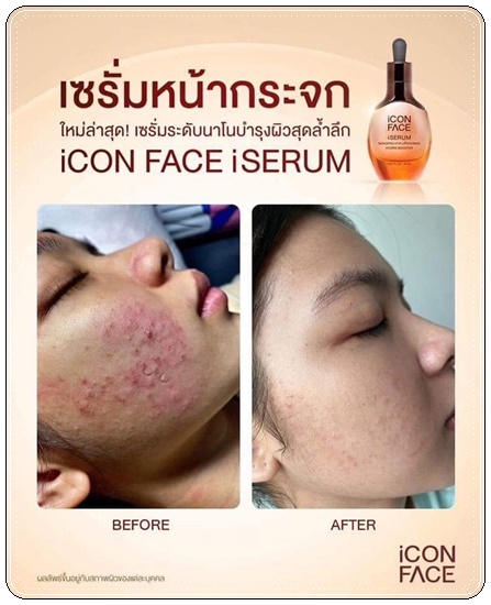เซรั่มหน้ากระจก iCon Face iSerum เซรั่มมินพีชญา (ของแท้)