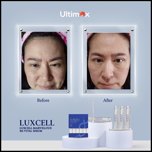 เซรั่มหน้าเด็ก Luxcell คุณภาพระดับสเต็มเซลล์ ของแท้
