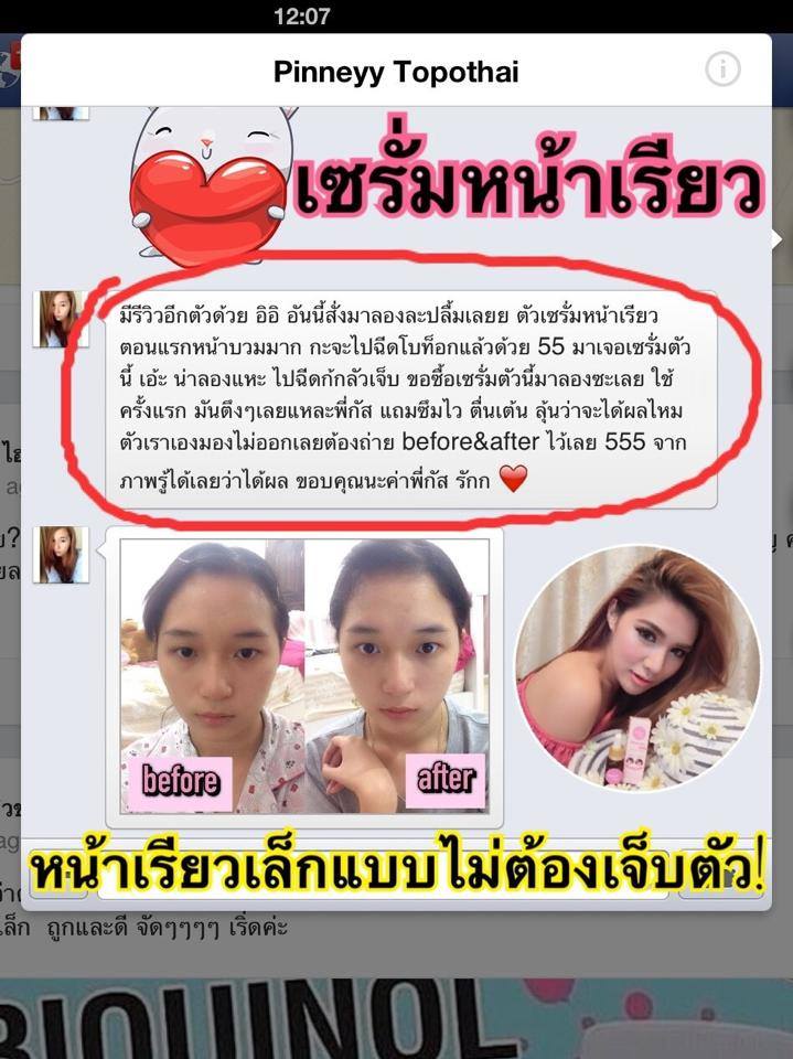 เซรั่มหน้าเรียวV-Shape Botox Serum