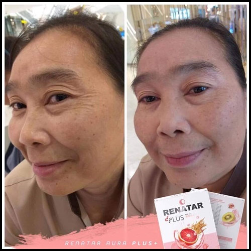 เรนาต้า ออร่าพลัส RENATAR AURA PLUS+ คอลลาเจนผิวใส