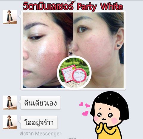 วิตามินเลเซอร์หน้าใส (lifting intense & repair serum By party white)