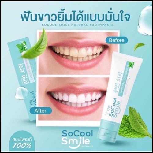 ยาสีฟัน SoCool Smile Natural Toothpaste (1แถม1)
