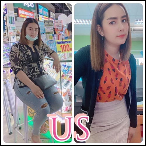 US อาหารเสริมลดน้ำหนัก สูตรดื้อยา