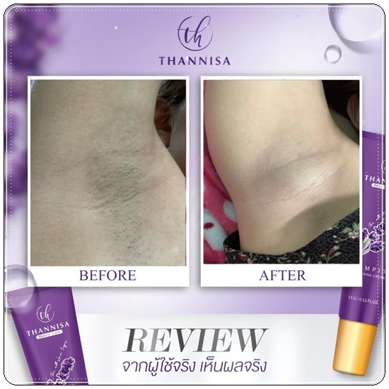 ครีมรักแร้ขาว ธัญนิสา Thannisa Armpit Whitening Cream (ส่งฟรี)
