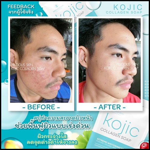 สบู่โคจิก คอลลาเจน โซป KOJIC Collagen soap