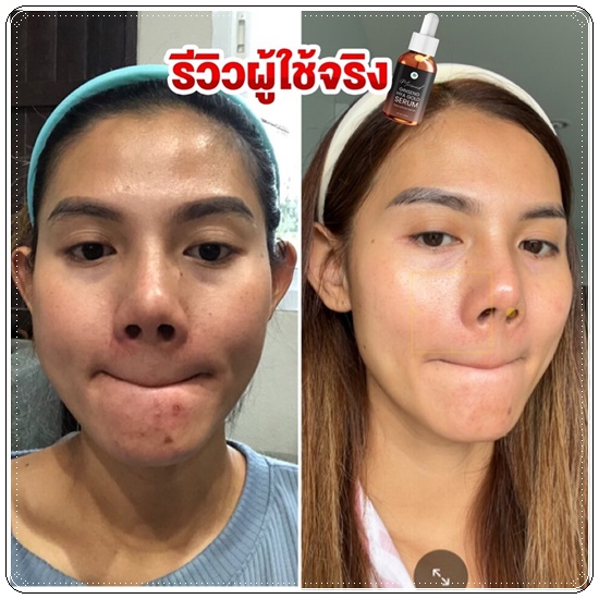 เซรั่มโสมทองไฮยา Ginseng HYA Gold Serum Mermaid