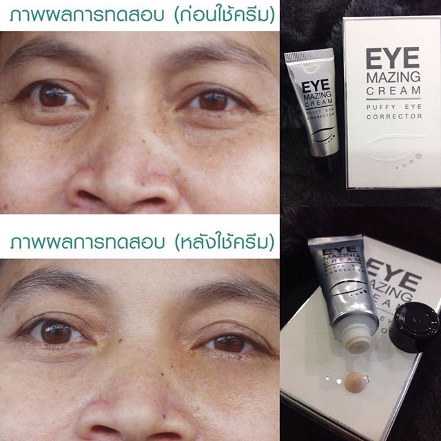 อายเมสซิ่ง ครีม (Eye Mazing Cream) ครีมลดริ้วรอยและถุงใต้ตา
