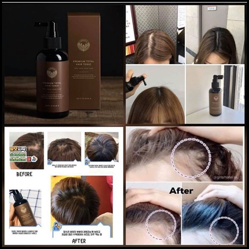 Terapic Premium Total Hair Tonic เซรั่มบำรุงผมหนา