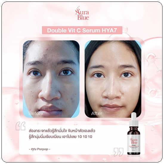 เซรั่มออร่าบลู Aura Blue Double Vitamin C Serum+HYA (ของแท้)