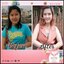 Boom Collagen+ บูม คอลลาเจน พลัส