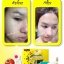 ครีมบล็อคสิว (Mini Block Set By Anya)