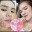 ครีมลิเดีย Lydia Cream ครีมรักษา สิว ฝ้า กระ แพคเกจใหม่
