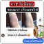 อัลตร้า ยู ครีม Ultra U Cream Natcha ลดอาการคัน กลากเกลื้อน