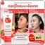 เจลกู้โทรมมะเขือเทศ Tomato Revitalizing Gel (ส่งฟรี)