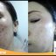เซรั่มวิตซี สลายฝ้า มารีแอน Mary Ann (โปรส่งฟรี)