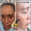 เซรั่ม Q Double Serum เซรั่มสลายฝ้า หน้าเด็ก (ของแท้ ส่งฟรี)